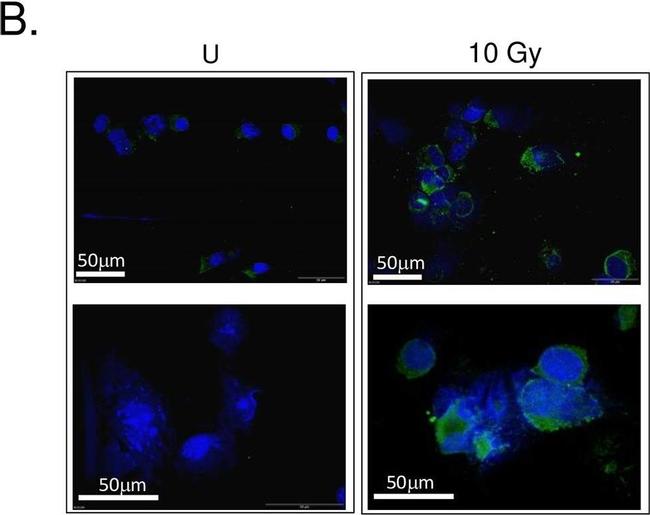 Mouse IgG (H+L) Highly Cross-Adsorbed Secondary Antibody in Immunocytochemistry (ICC/IF)