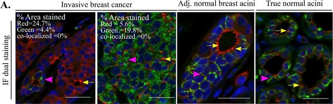 Mouse IgG (H+L) Highly Cross-Adsorbed Secondary Antibody in Immunohistochemistry (Paraffin) (IHC (P))