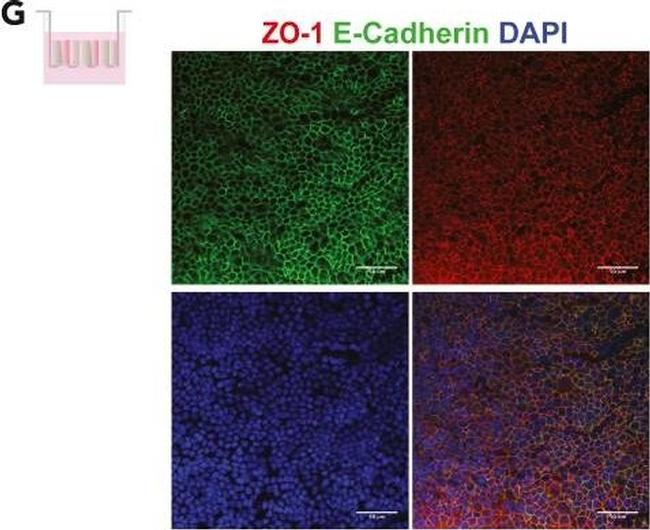 Mouse IgG (H+L) Highly Cross-Adsorbed Secondary Antibody in Immunohistochemistry (IHC)