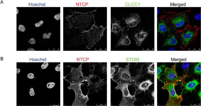 Mouse IgG (H+L) Highly Cross-Adsorbed Secondary Antibody in Immunocytochemistry (ICC/IF)