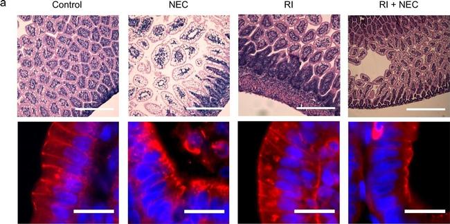 Mouse IgG (H+L) Highly Cross-Adsorbed Secondary Antibody in Immunocytochemistry (ICC/IF)