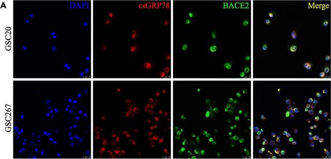 Rabbit IgG (H+L) Highly Cross-Adsorbed Secondary Antibody in Immunocytochemistry (ICC/IF)