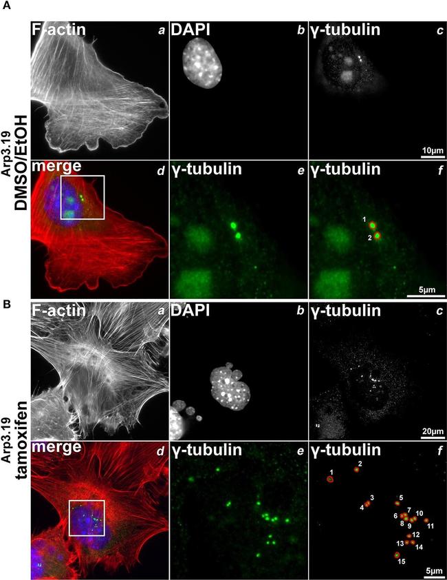 Rabbit IgG (H+L) Highly Cross-Adsorbed Secondary Antibody in Immunocytochemistry (ICC/IF)