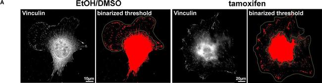 Mouse IgG (H+L) Highly Cross-Adsorbed Secondary Antibody in Immunocytochemistry (ICC/IF)