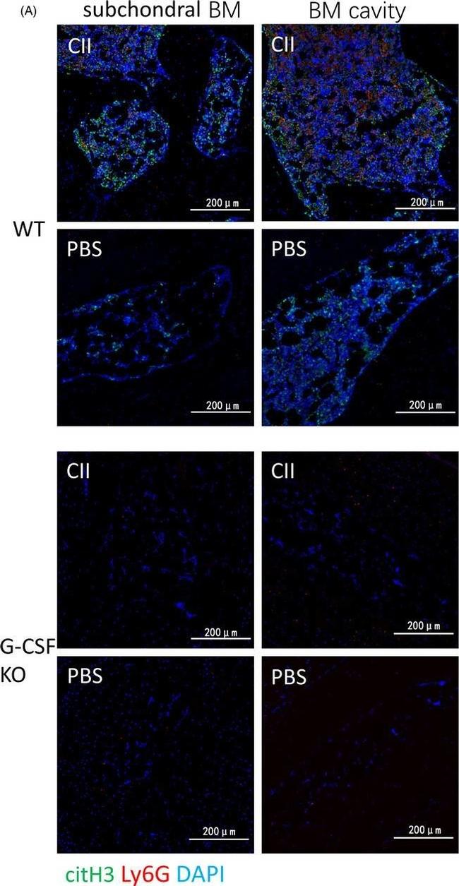 Rat IgG (H+L) Cross-Adsorbed Secondary Antibody in Immunohistochemistry (IHC)