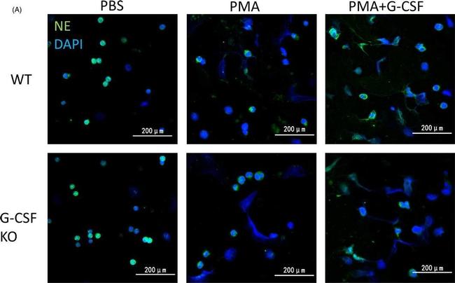 Rat IgG (H+L) Cross-Adsorbed Secondary Antibody in Immunohistochemistry (IHC)