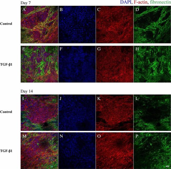 Rabbit IgG (H+L) Highly Cross-Adsorbed Secondary Antibody in Immunocytochemistry (ICC/IF)