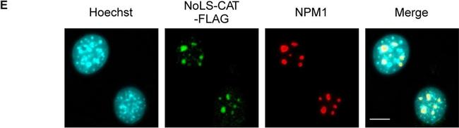 Rabbit IgG (H+L) Highly Cross-Adsorbed Secondary Antibody in Immunocytochemistry (ICC/IF)