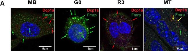 Rabbit IgG (H+L) Highly Cross-Adsorbed Secondary Antibody in Immunocytochemistry (ICC/IF)