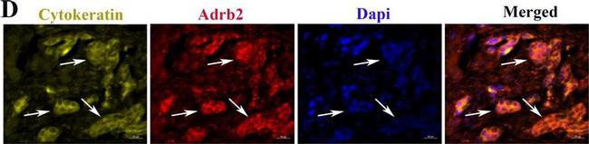 Mouse IgM (Heavy chain) Cross-Adsorbed Secondary Antibody in Immunohistochemistry (IHC)