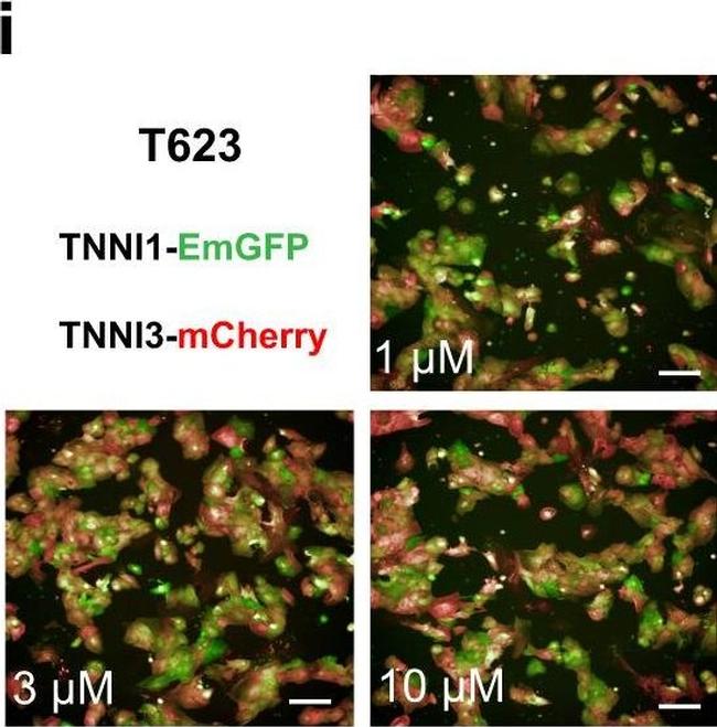 Rabbit IgG (H+L) Highly Cross-Adsorbed Secondary Antibody in Immunocytochemistry (ICC/IF)