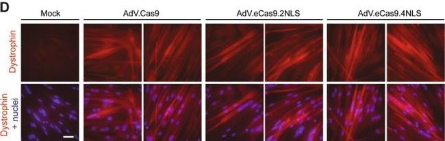 Rabbit IgG (H+L) Highly Cross-Adsorbed Secondary Antibody in Immunocytochemistry (ICC/IF)