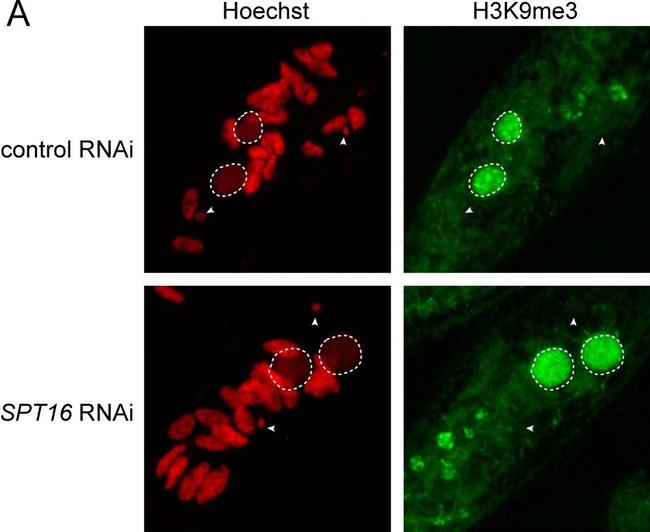 Rabbit IgG (H+L) Highly Cross-Adsorbed Secondary Antibody in Immunocytochemistry (ICC/IF)