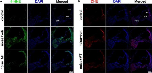 Rabbit IgG (H+L) Highly Cross-Adsorbed Secondary Antibody in Immunohistochemistry (IHC)