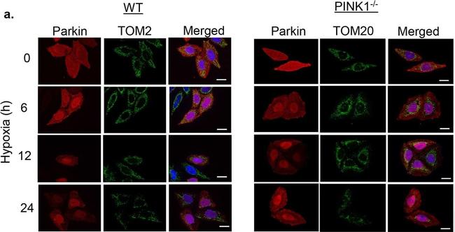 Rabbit IgG (H+L) Highly Cross-Adsorbed Secondary Antibody in Immunocytochemistry (ICC/IF)