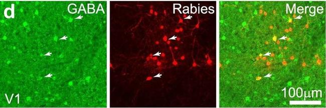 Rabbit IgG (H+L) Highly Cross-Adsorbed Secondary Antibody in Immunohistochemistry (IHC)