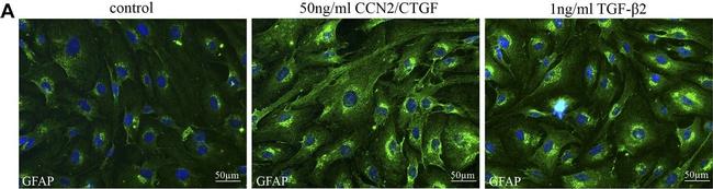 Rabbit IgG (H+L) Highly Cross-Adsorbed Secondary Antibody in Immunocytochemistry (ICC/IF)