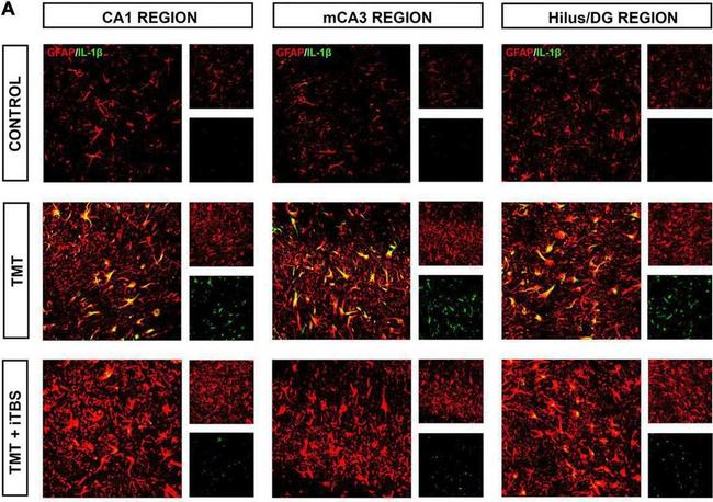 Rabbit IgG (H+L) Cross-Adsorbed Secondary Antibody in Immunohistochemistry (IHC)