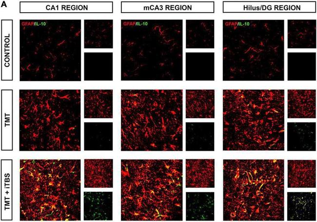 Rabbit IgG (H+L) Cross-Adsorbed Secondary Antibody in Immunohistochemistry (IHC)