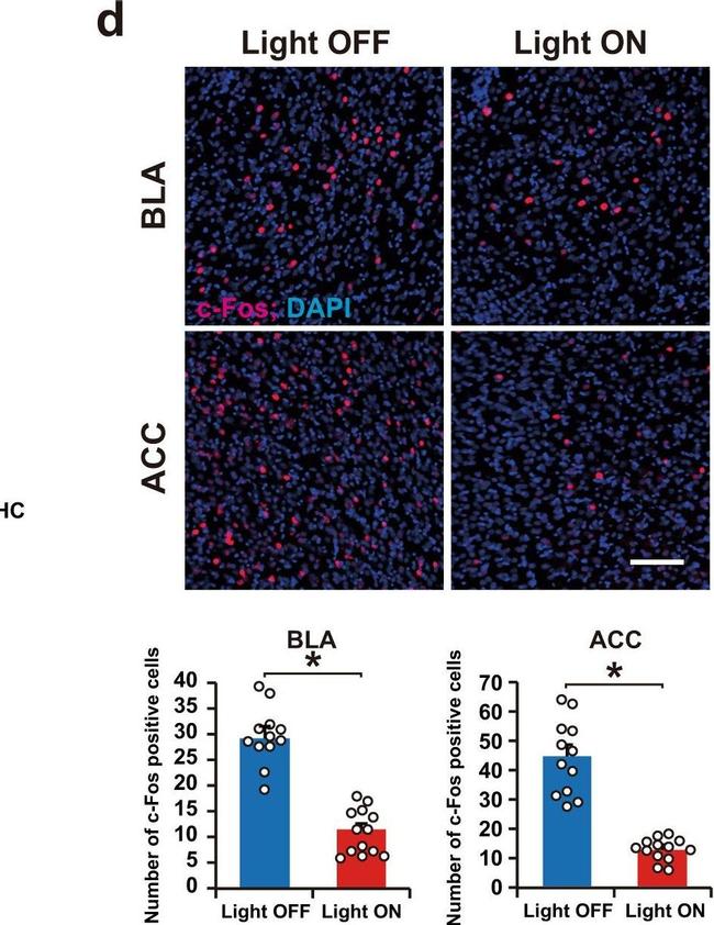 Rabbit IgG (H+L) Highly Cross-Adsorbed Secondary Antibody in Immunohistochemistry (IHC)