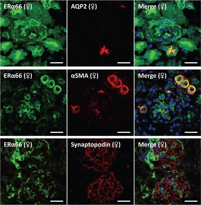 Goat IgG (H+L) Cross-Adsorbed Secondary Antibody in Immunohistochemistry (Frozen) (IHC (F))