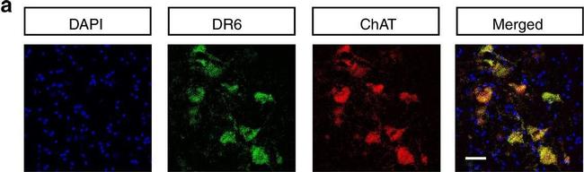 Goat IgG (H+L) Cross-Adsorbed Secondary Antibody in Immunohistochemistry (Frozen) (IHC (F))