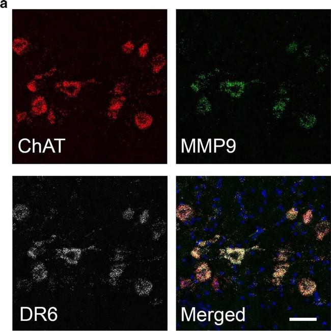 Goat IgG (H+L) Cross-Adsorbed Secondary Antibody in Immunohistochemistry (Frozen) (IHC (F))