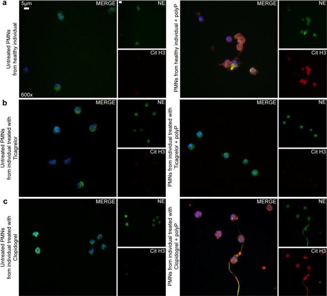 Mouse IgG (H+L) Cross-Adsorbed Secondary Antibody in Immunocytochemistry (ICC/IF)