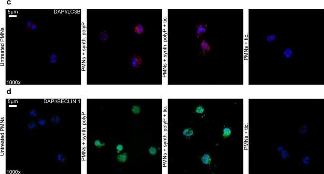 Rabbit IgG (H+L) Cross-Adsorbed Secondary Antibody in Immunocytochemistry (ICC/IF)