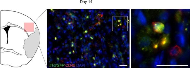 Rabbit IgG (H+L) Cross-Adsorbed Secondary Antibody in Immunohistochemistry (IHC)