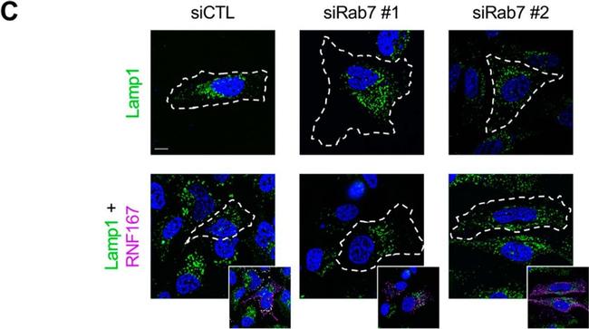 Rabbit IgG (H+L) Cross-Adsorbed Secondary Antibody in Immunocytochemistry (ICC/IF)