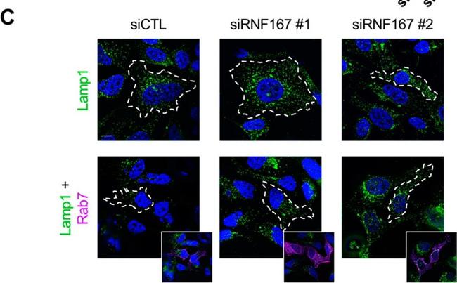 Rabbit IgG (H+L) Cross-Adsorbed Secondary Antibody in Immunocytochemistry (ICC/IF)