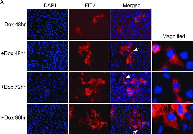 Rabbit IgG (H+L) Cross-Adsorbed Secondary Antibody in Immunocytochemistry (ICC/IF)