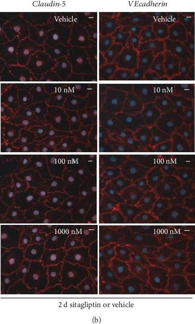 Rabbit IgG (H+L) Cross-Adsorbed Secondary Antibody in Immunocytochemistry (ICC/IF)