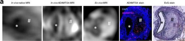 Rabbit IgG (H+L) Highly Cross-Adsorbed Secondary Antibody in Immunohistochemistry (IHC)