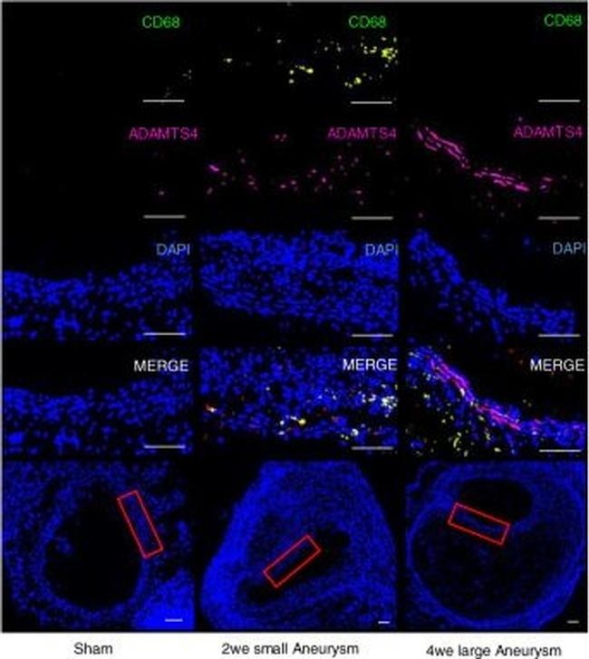 Rabbit IgG (H+L) Highly Cross-Adsorbed Secondary Antibody in Immunohistochemistry (IHC)