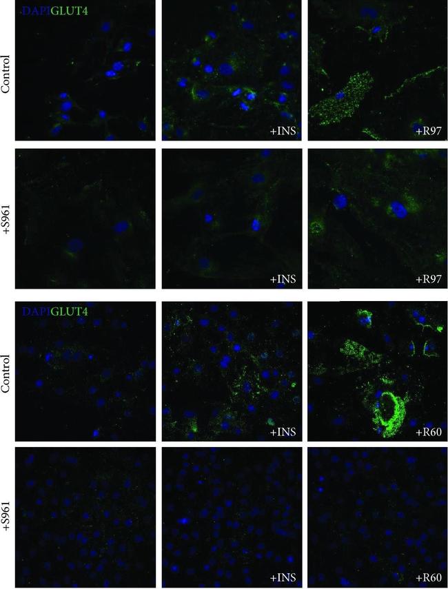 Goat IgG (H+L) Cross-Adsorbed Secondary Antibody in Immunocytochemistry (ICC/IF)