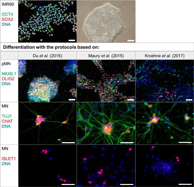 Goat IgG (H+L) Cross-Adsorbed Secondary Antibody in Immunocytochemistry (ICC/IF)