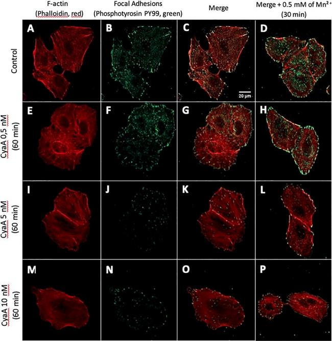 Mouse IgM (Heavy chain) Cross-Adsorbed Secondary Antibody in Immunocytochemistry (ICC/IF)