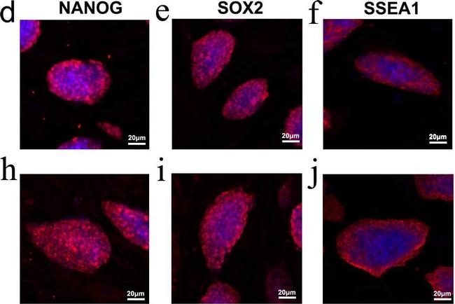 Mouse IgM (Heavy chain) Cross-Adsorbed Secondary Antibody in Immunocytochemistry (ICC/IF)