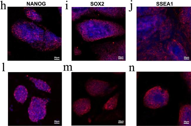 Mouse IgM (Heavy chain) Cross-Adsorbed Secondary Antibody in Immunocytochemistry (ICC/IF)