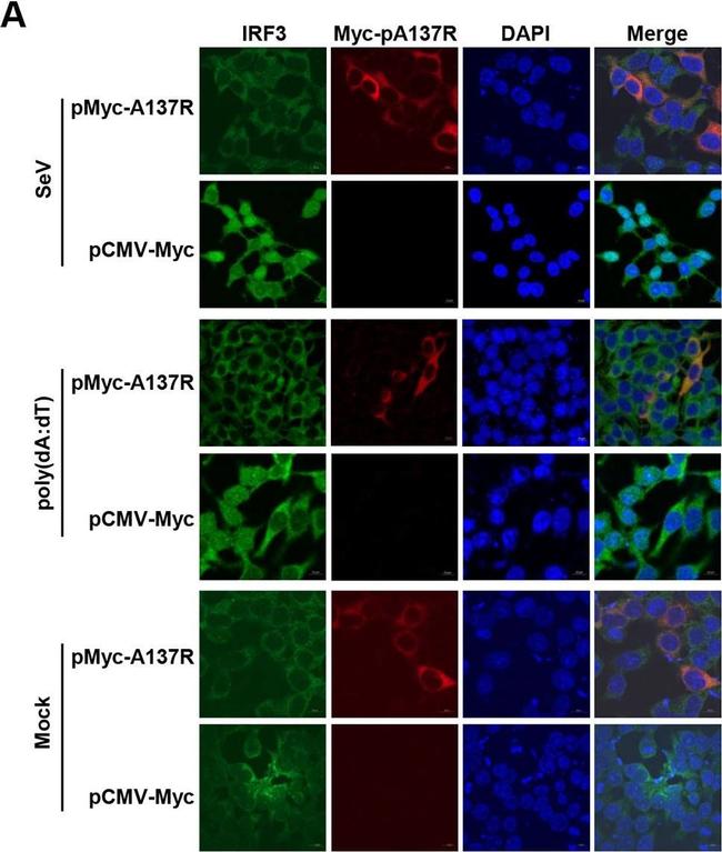 Rabbit IgG (H+L) Highly Cross-Adsorbed Secondary Antibody in Immunocytochemistry (ICC/IF)