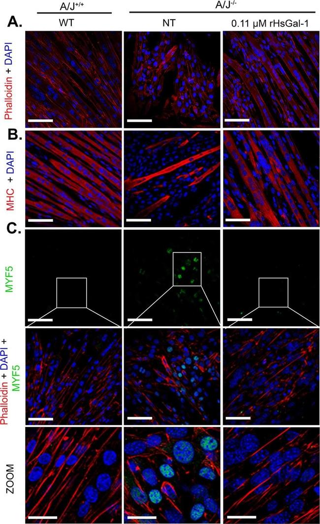 Mouse IgG (H+L) Highly Cross-Adsorbed Secondary Antibody in Immunocytochemistry (ICC/IF)