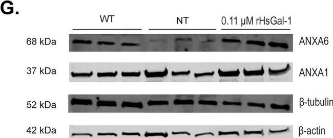 Mouse IgG (H+L) Highly Cross-Adsorbed Secondary Antibody in Western Blot (WB)