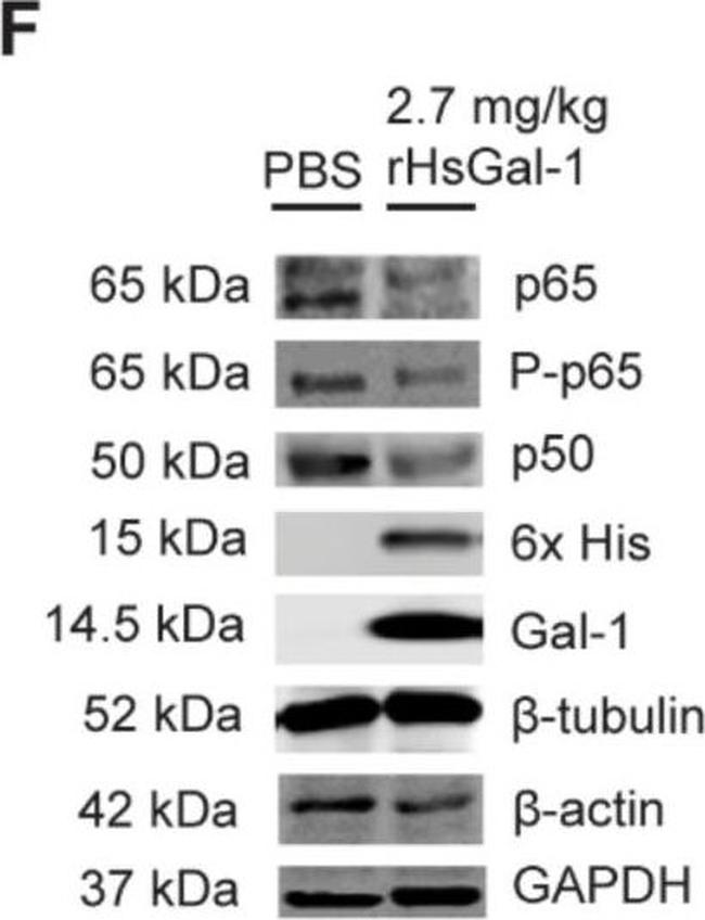 Mouse IgG (H+L) Highly Cross-Adsorbed Secondary Antibody in Western Blot (WB)