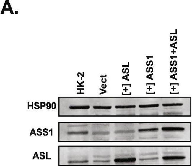 Rabbit IgG (H+L) Highly Cross-Adsorbed Secondary Antibody in Western Blot (WB)