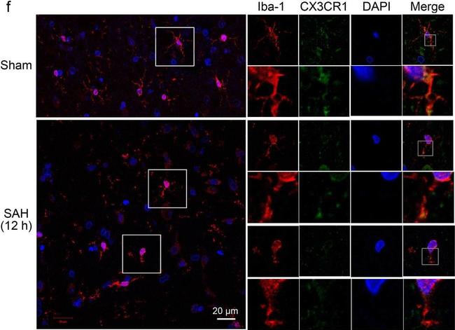 Goat IgG (H+L) Cross-Adsorbed Secondary Antibody in Immunohistochemistry (IHC)