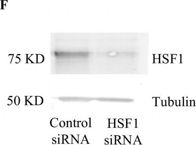 Rabbit IgG (H+L) Highly Cross-Adsorbed Secondary Antibody in Western Blot (WB)