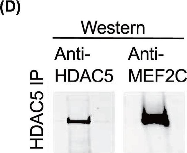 Rabbit IgG (H+L) Highly Cross-Adsorbed Secondary Antibody in Western Blot (WB)