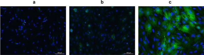 Mouse IgG1 Cross-Adsorbed Secondary Antibody in Immunocytochemistry (ICC/IF)